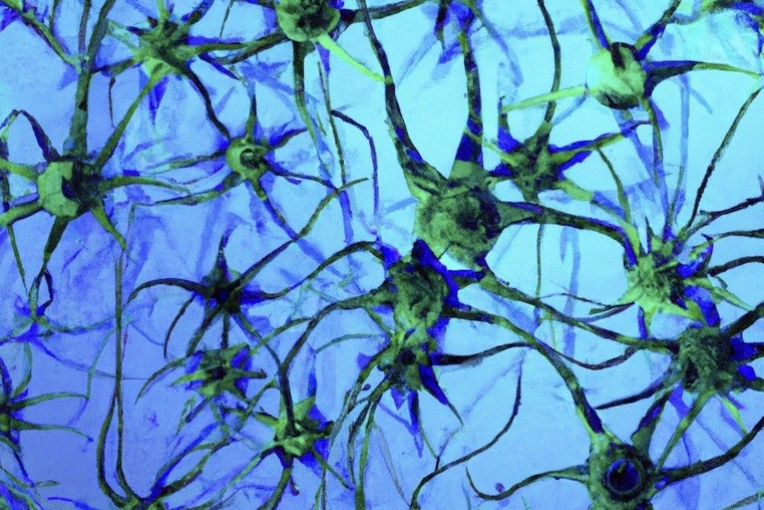 Cellule nervose disegnate da un sistema di intelligenza artificiale (©  Shutterstock) 