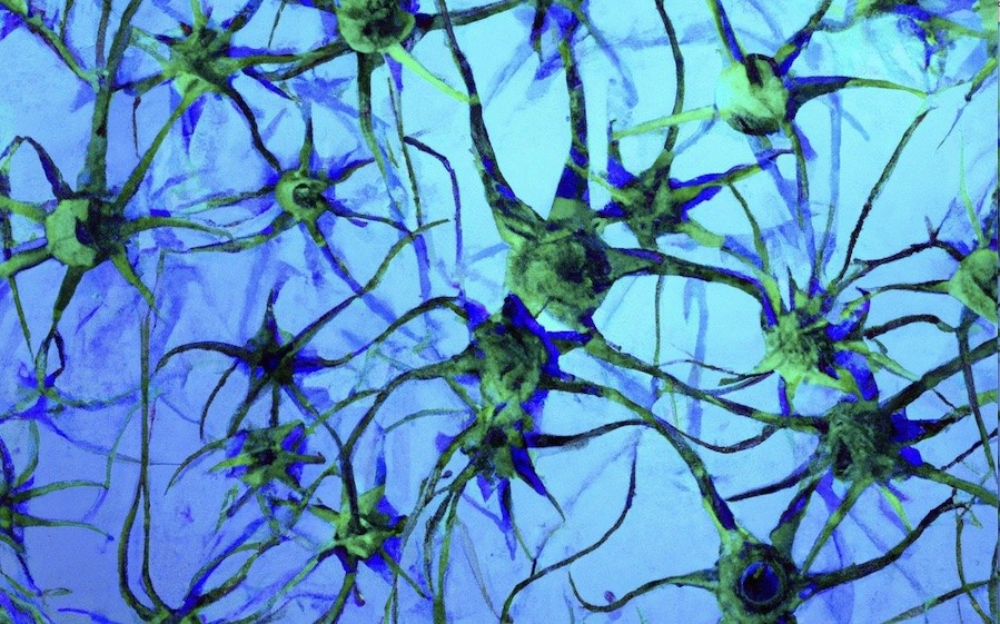 Cellule nervose disegnate da un sistema di intelligenza artificiale (©  Shutterstock) 