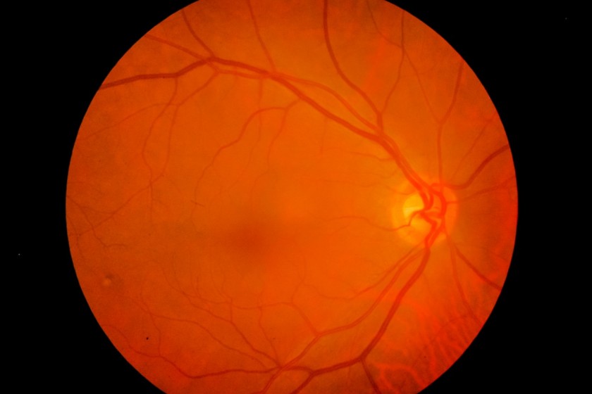 Un’immagine del fondo dell’occhio (Shutterstock)
