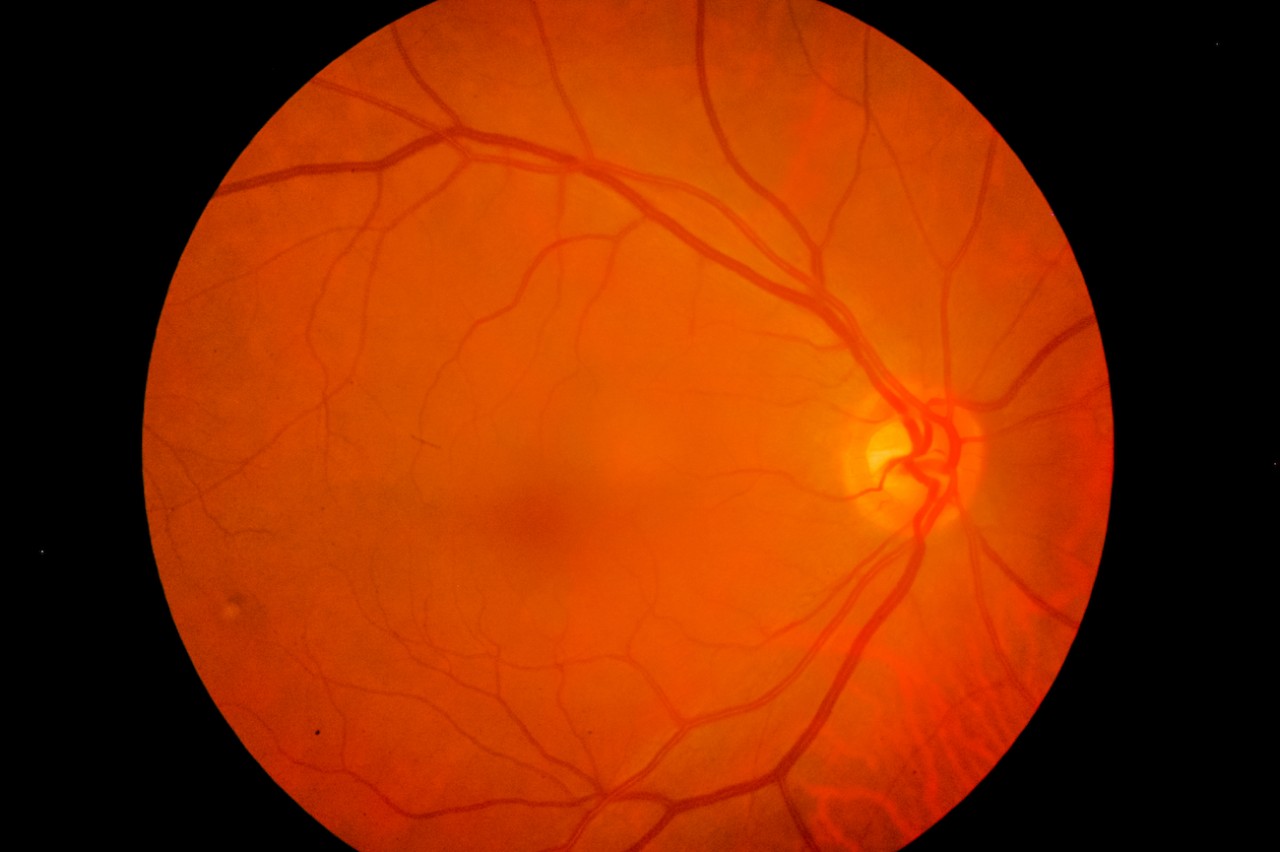 Un’immagine del fondo dell’occhio (Shutterstock)