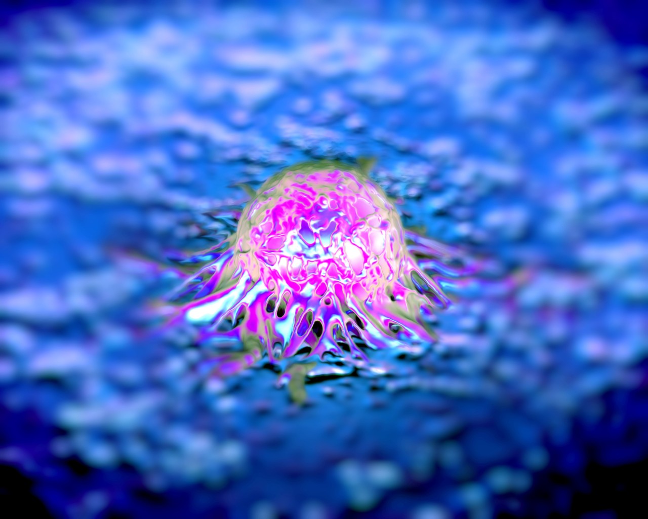 Cellule di tumore della prostata osservate tramite la microscopia elettronica a scansione (foto Shutterstock) Cellule di tumore della prostata osservate tramite la microscopia elettronica a scansione (foto Shutterstock)