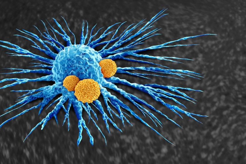 Una cellula tumorale (azzurra) viene attaccata dai linfociti (cellule del sistema immunitario). Rielaborazione al computer dell’agenzia iStock