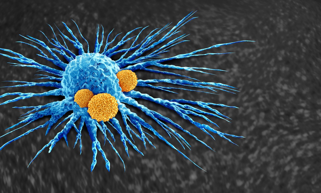Una cellula tumorale (azzurra) viene attaccata dai linfociti (cellule del sistema immunitario). Rielaborazione al computer dell’agenzia iStock Una cellula tumorale (azzurra) viene attaccata dai linfociti (cellule del sistema immunitario). Rielaborazione al computer dell’agenzia iStock