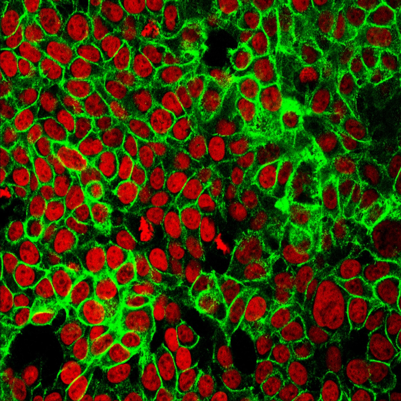 Cellule tumorali osservate al microscopio a fluorescenza: i nuclei appaiono in rosso, le membrane cellulari in verde (foto del National Cancer Institute, su Unsplash)
